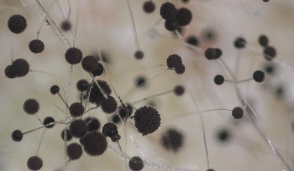 a close up of microscopic black mold spores on water filter