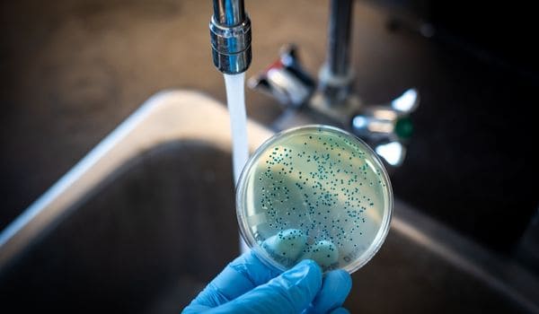 A picture of water contaminants on a petri dish.